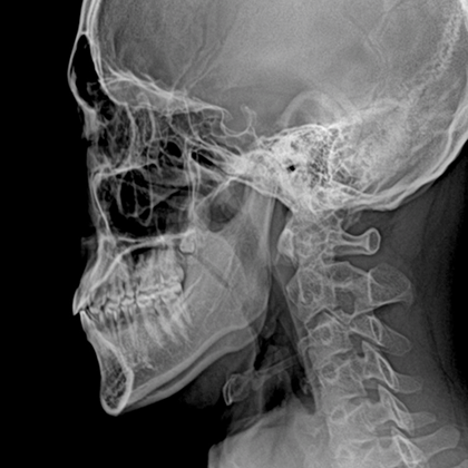 X-Ray img
