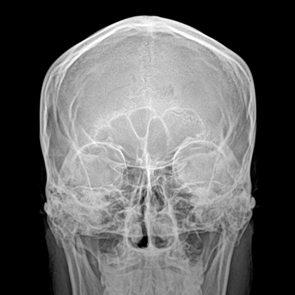 X-Ray img