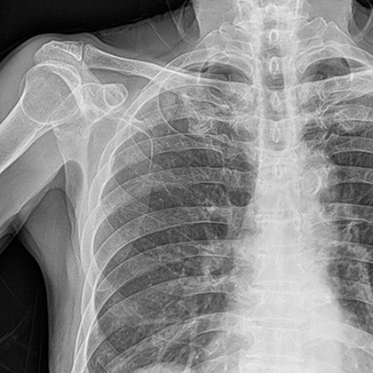 X-Ray img
