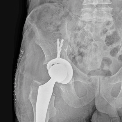 X-Ray img